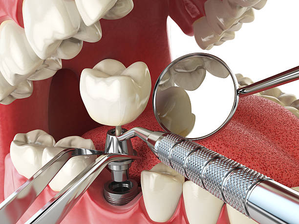 Best Emergency Gum Treatment in Dresden, TN
